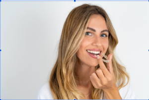 invisalign express before and after